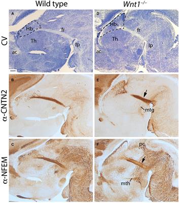 Wnt1 Role in the Development of the Habenula and the Fasciculus Retroflexus